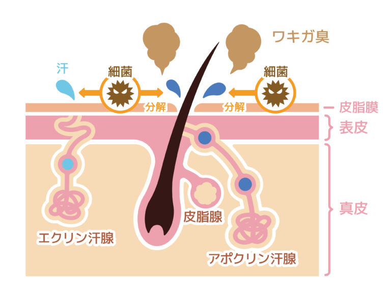 わきの汗・におい