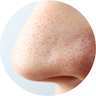 毛穴