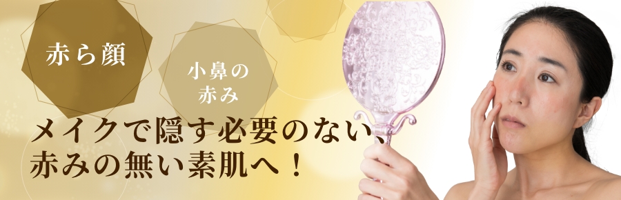 赤ら顔