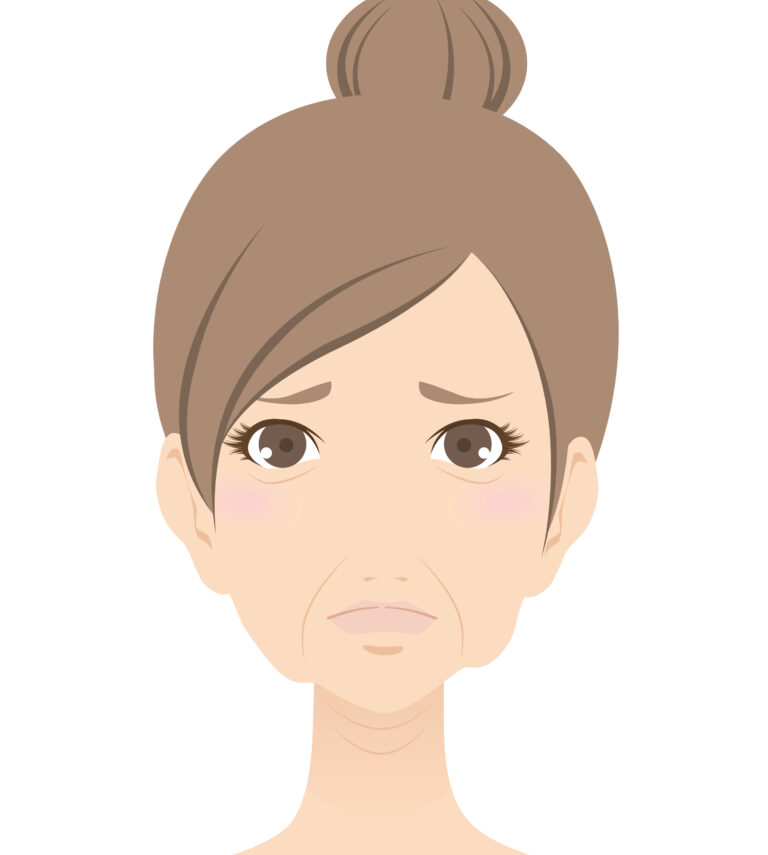 たるみができる原因